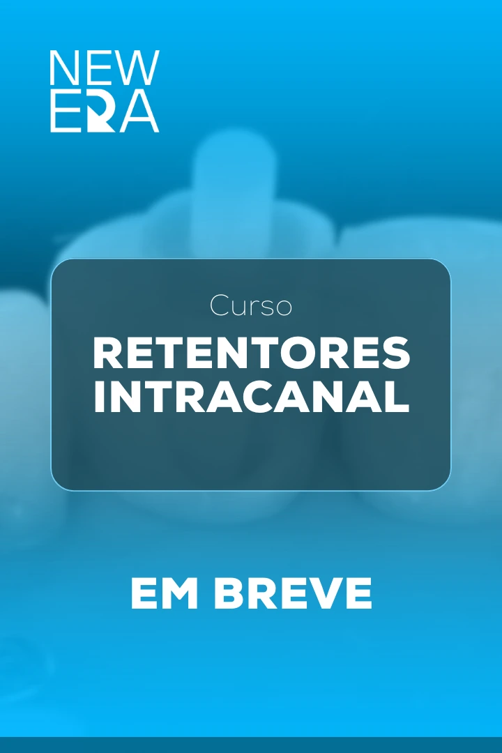 Retentores Intracanal
