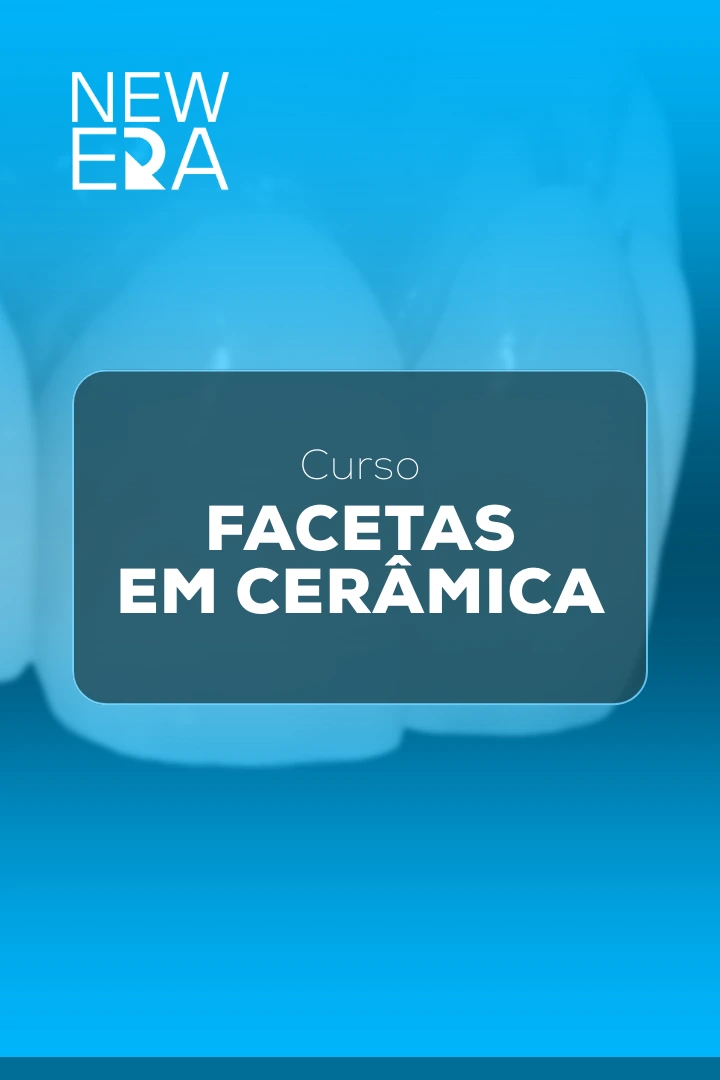 facetas em cerâmica